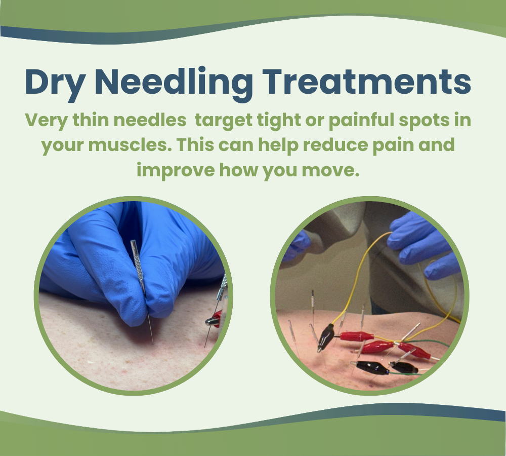 Dry Needling Treatments Very thin needles  target tight or painful spots in your muscles. This can help reduce pain and improve how you move.